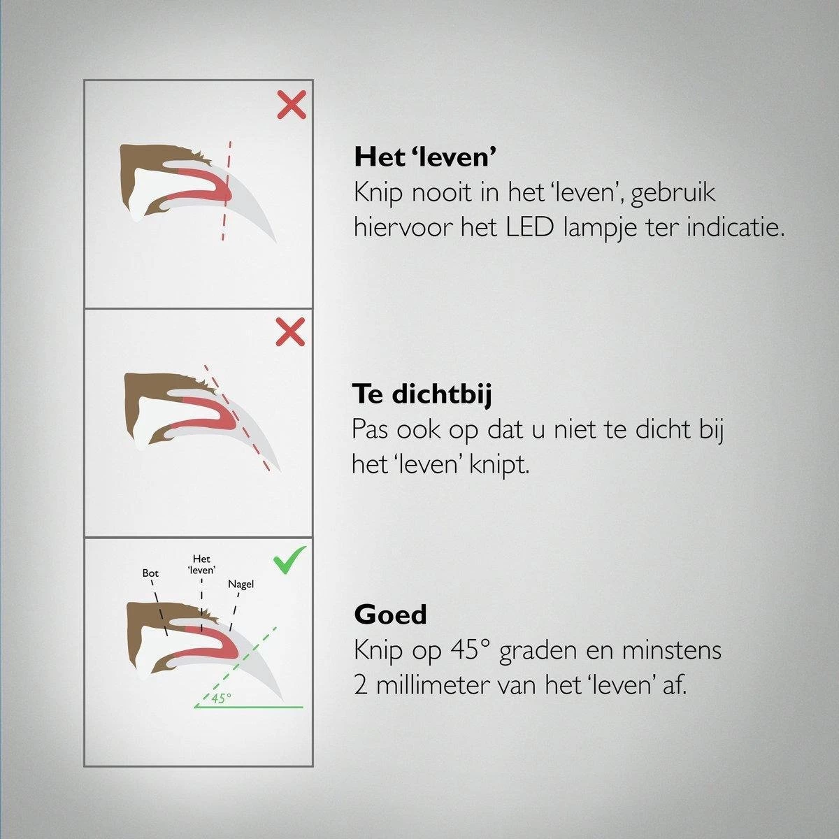 PETKIT® Professionele Dieren Nagelknipper - Nagelknipper Hond - Met LED - Met Vijl - Nageltang 10 PETKIT® Professionele Dieren Nagelknipper - Nagelknipper Hond - Met LED - Met Vijl - Nageltang - Afbeelding 8