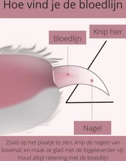 Professionele Nagelschaar | Nagelschaar Hond | Nagelschaar Kat | Nagelknipper Hond En Kat | Nagelknipper Kat| Nagelknipper Hond | NagelTang Dieren | Poot Verzorging -Katten Hondenbenodigdheden Winkel 942x1200
